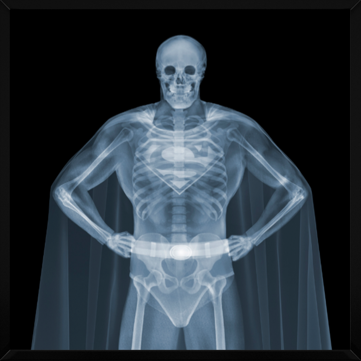直筆サイン入り　Visions of Sonwai ハードカバー アートブック Superman | Nick Veasey – Clarendon Fine Art